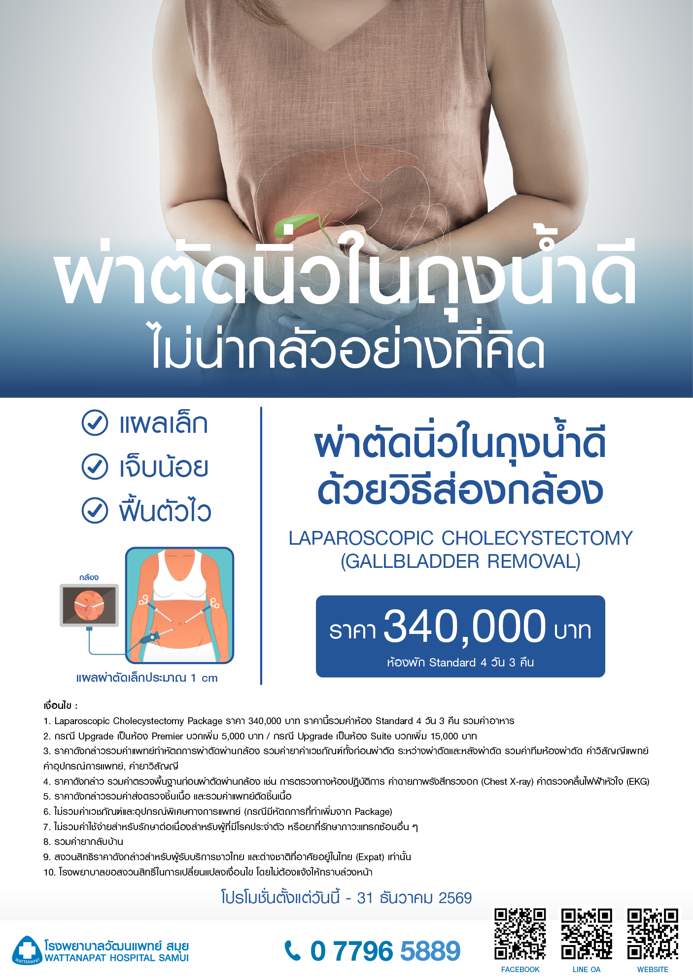 Brochure_แพ็กเกจผ่าตัดนิ่วในถุงน้ำดี ด้วยวิธีส่องกล้อง.png
