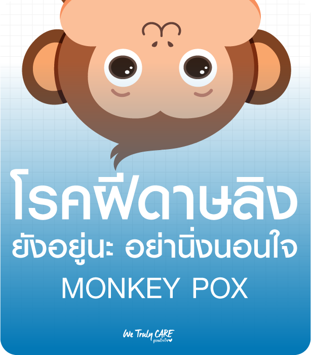 รู้จักโรคฝีดาษลิง