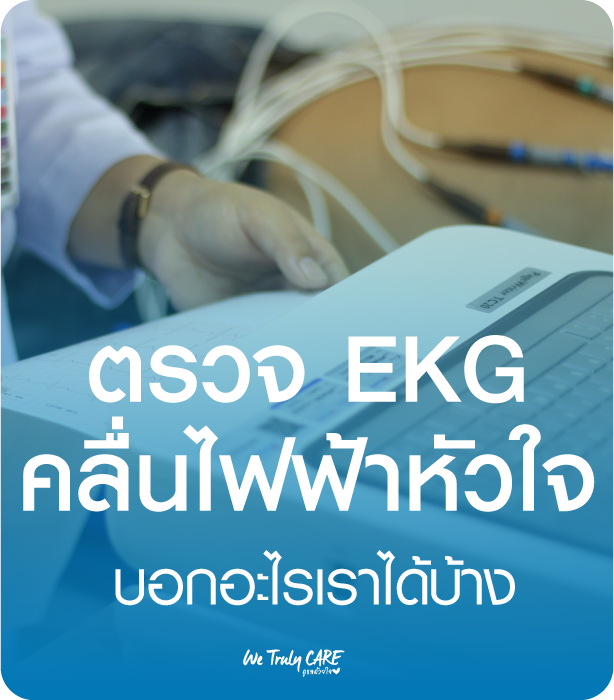 ตรวจคลื่นไฟฟ้าหัวใจ EKG บอกอะไรเราได้บ้าง