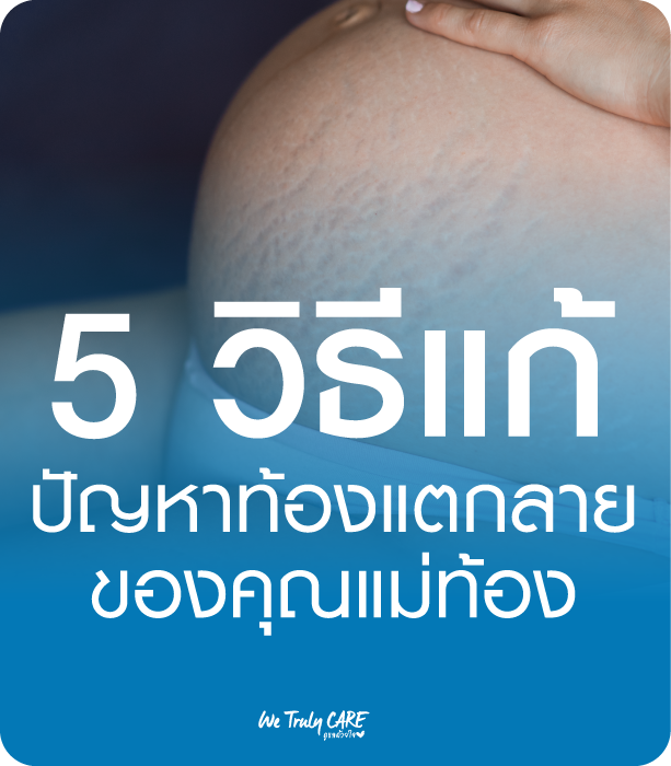 5 วิธีแก้ปัญหา ท้องแตกลายของคุณแม่ท้อง