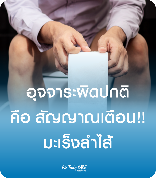 อุจจาระผิดปกติ อาจเป็นสัญญาณเตือน ควรตรวจมะเร็งลำไส้