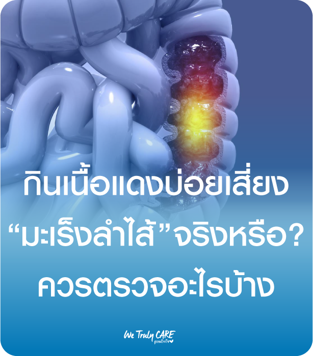 กินเนื้อแดงบ่อย เสี่ยงมะเร็งลำไส้จริงหรือ? ควรตรวจอะไรบ้าง