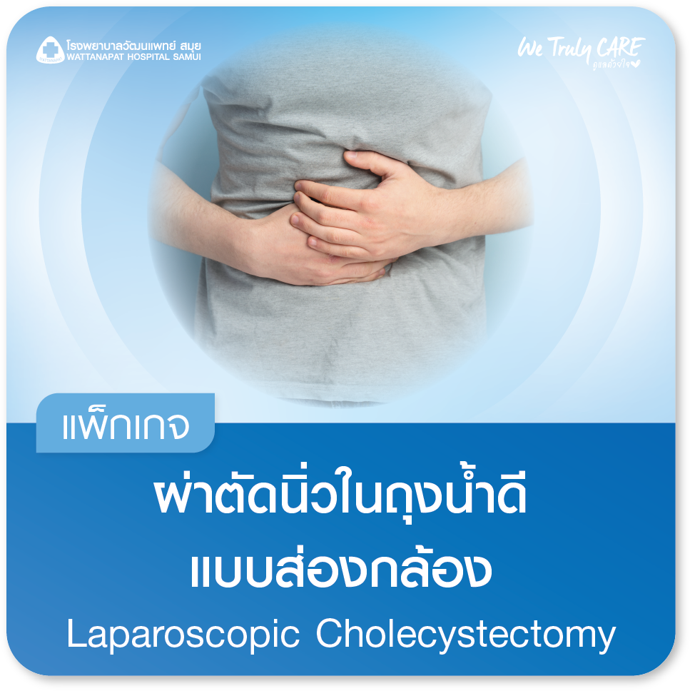 แพ็กเกจผ่าตัดนิ่วในถุงน้ำดีแบบส่องกล้อง