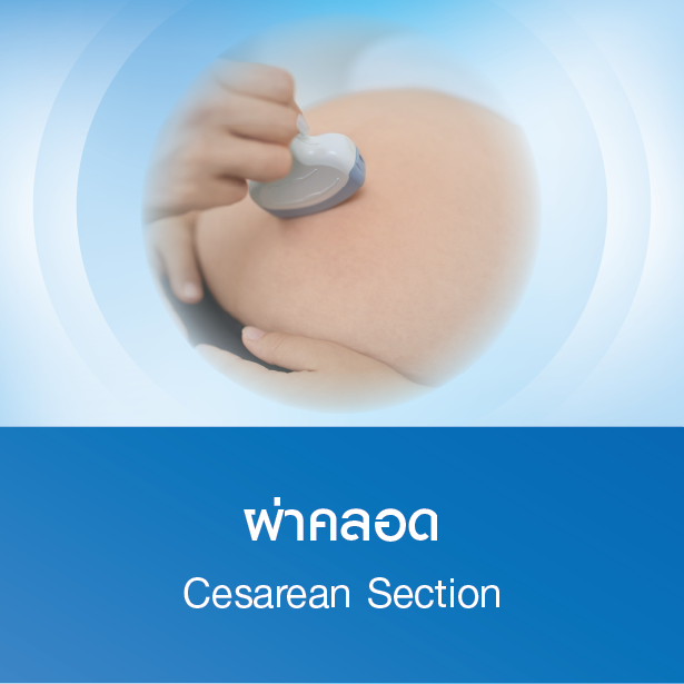 แพ็กเกจผ่าคลอด