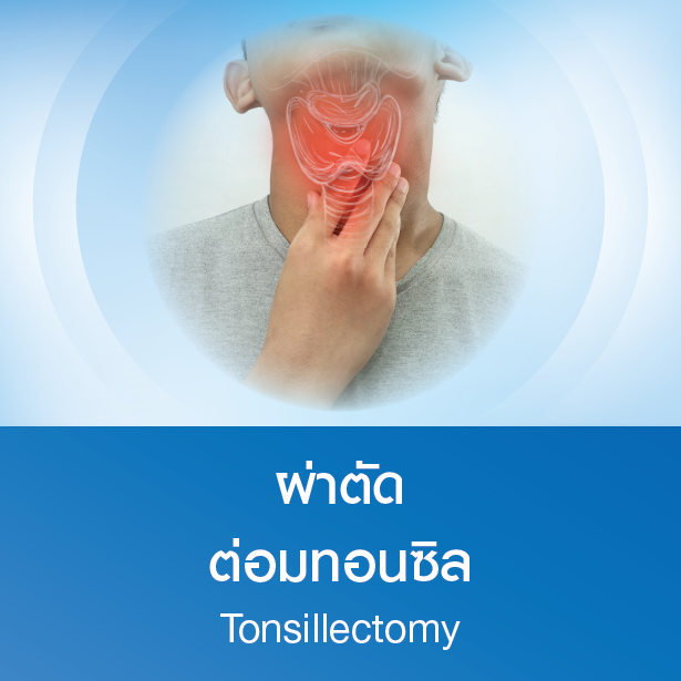 แพ็กเกจผ่าตัดต่อมทอนซิล