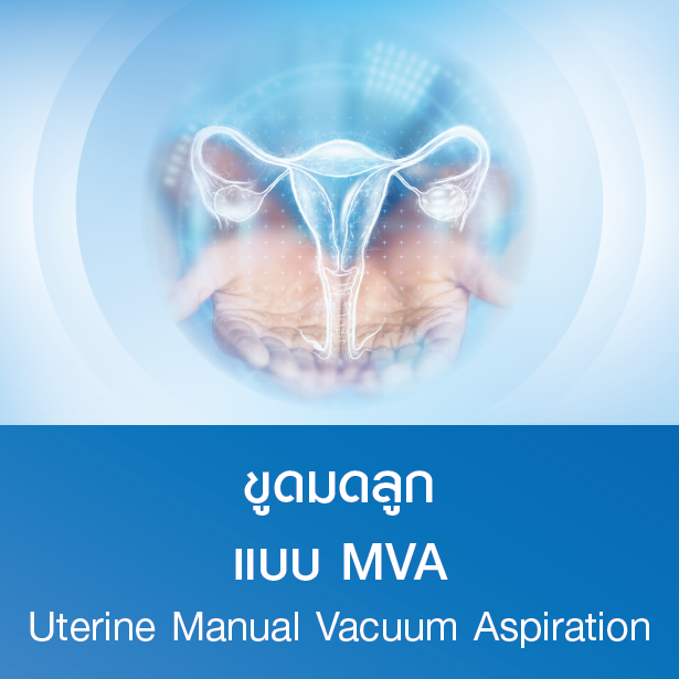 แพ็กเกจขูดมดลูกแบบ MVA
