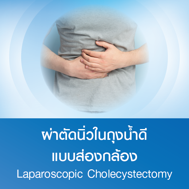 Laparoscopic Cholecystectomy Package
