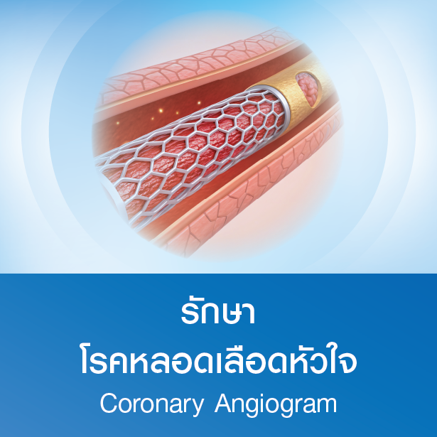 แพ็กเกจรักษาโรคหลอดเลือดหัวใจ