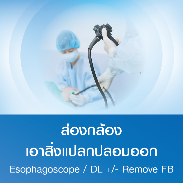 แพ็กเกจส่องกล้องเอาสิ่งแปลกปลอมออก