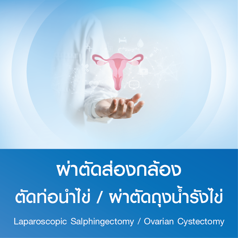 แพ็กเกจผ่าตัดส่องกล้องตัดท่อนำไข่ / ผ่าตัดถุงน้ำรังไข่